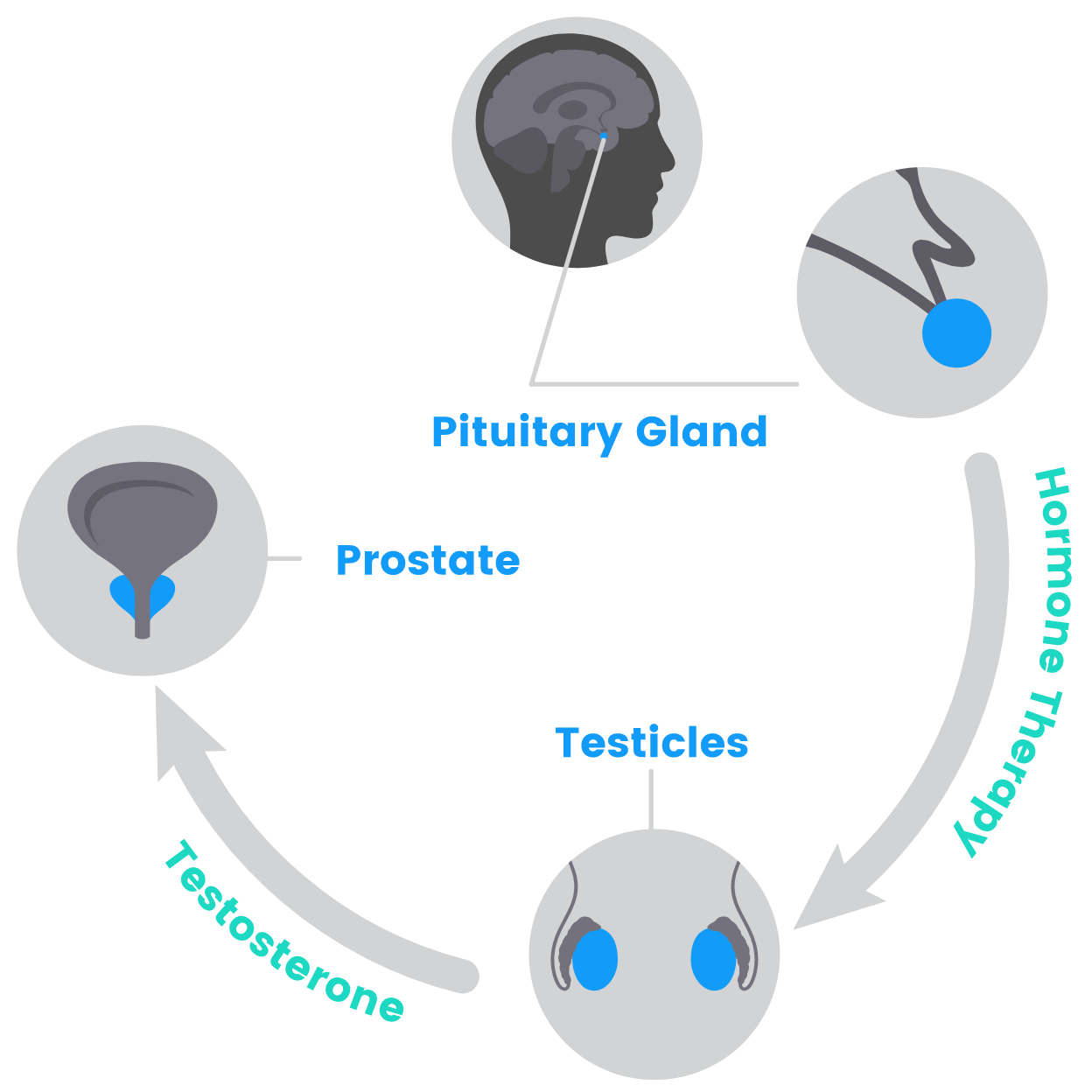 Illustration showing how androgen deprivation therapy affects the prostate through the testicles